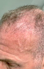 Load image into Gallery viewer, JSF GROWTH PHASE