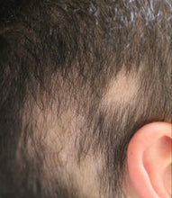 Load image into Gallery viewer, JSF GROWTH PHASE