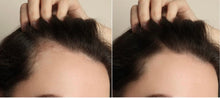 Load image into Gallery viewer, GROWTH PHASE MIN/RU: The Ultimate Hair Regrowth Solution for Minoxidil Users
