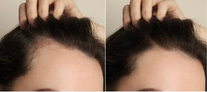 GROWTH PHASE MIN/RU: The Ultimate Hair Regrowth Solution for Minoxidil Users