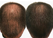 Load image into Gallery viewer, GROWTH PHASE MIN/RU: The Ultimate Hair Regrowth Solution for Minoxidil Users
